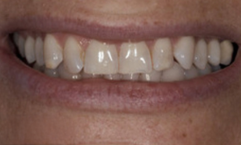 Close-up of a person's smile showcasing teeth, relevant to dental services and smile makeovers offered by Dr. Palani.